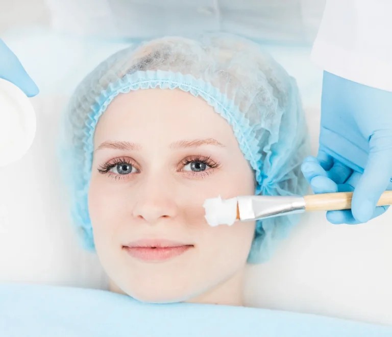 إزالة آثار حب الشباب نهائيًا بطرق طبية فعّالة وآمنة للحصول على بشرة صافية