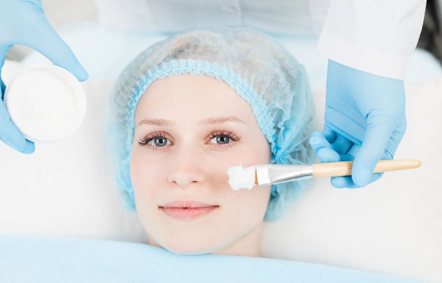 إزالة آثار حب الشباب