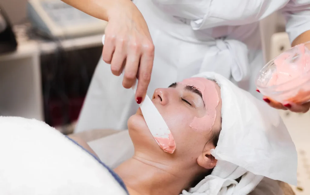 التقشير الكيميائي