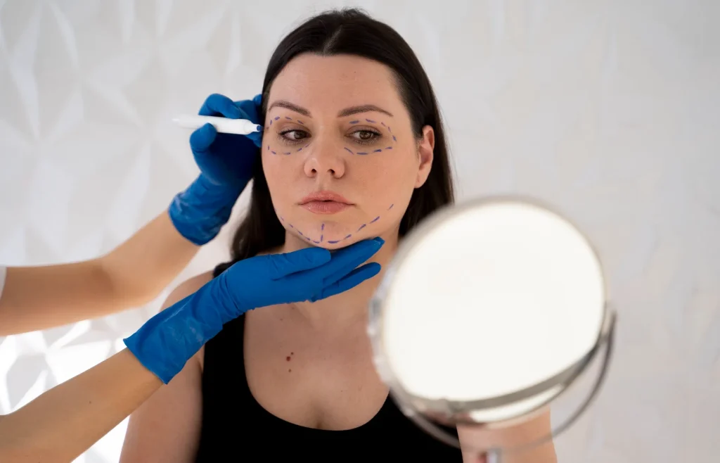 التقشير الكيميائي