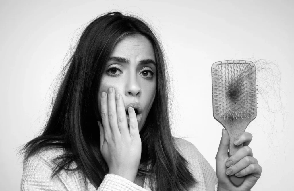 تساقط الشعر