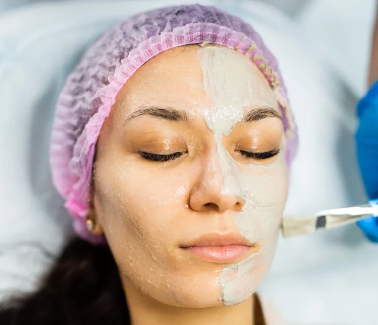 جلسات التقشير الكيميائي للبشرة وفوائدها والفرق بين أنواع التقشير للحصول على بشرة مميزة وصحية