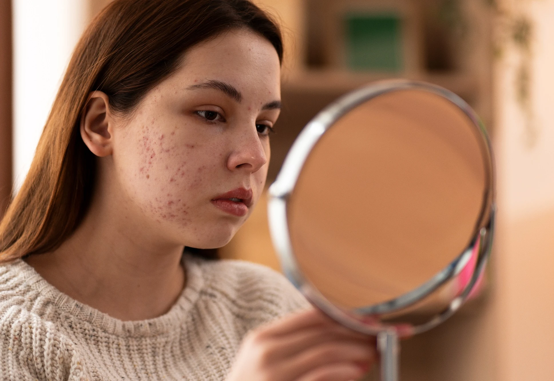 الحل الجذري لعلاج حبوب الشباب