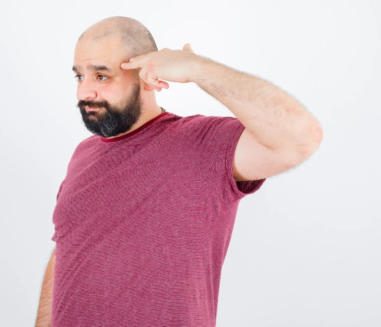 الصلع الوراثي والصلع التفاعلي: الفرق بينهما وطرق العلاج الفعّالة